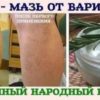 Лучшие народные рецепты от варикоза