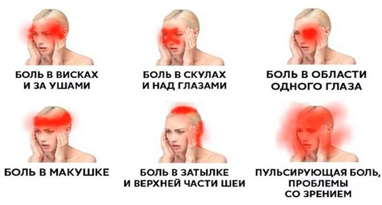 О чем говорит боль в разных частях головы