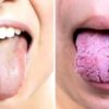 3 вещи, которые ваш язык пытается рассказать о вашем здоровье