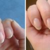 Как быстро отрастить ногти, которые никогда не сломаются — простое средство из 4 компонентов!