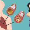 Как устранить слизь и мокроту из горла и груди (мгновенный результат)