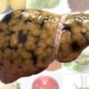 ПЕЧЕНЬ И ЕЕ 13 ЛЮБИМЫХ ПРОДУКТОВ… ЭТО СТОИТ ЗНАТЬ