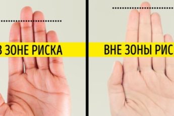 Признаки серьезных заболеваний, которые мы даже не замечаем