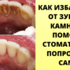Как избавиться от зубного камня дома, без помощи стоматолога