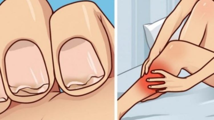 Кальция нехватки: 9 признаков, которые никогда нельзя игнорировать