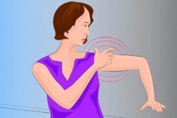 8 симптомов инсульта, о которых особенно должны знать женщины