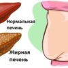 6 явных признаков того, что Ваша печень полна токсинов и вредных элементов