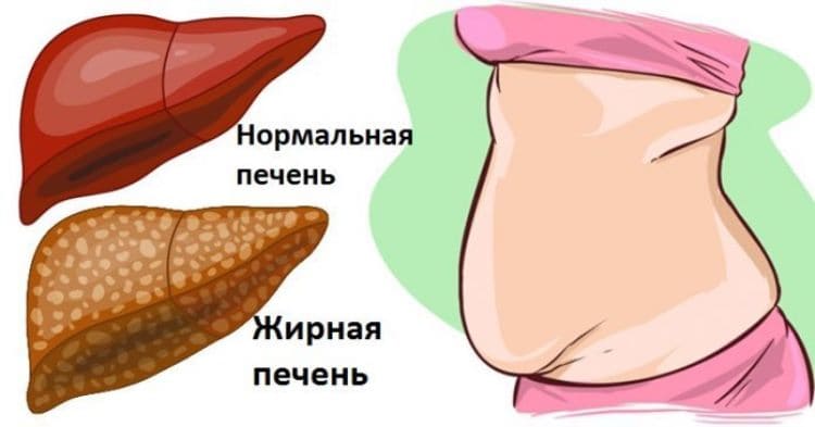 6 явных признаков того, что Ваша печень полна токсинов и вредных элементов