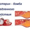 Как Оказалось, Очистить Сосуды От Холестерина Можно Без Врачей И Таблеток!Невероятно!