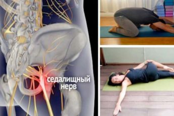 8 упражнений, с которыми Вы навсегда забудете о радикулите и болях в спине