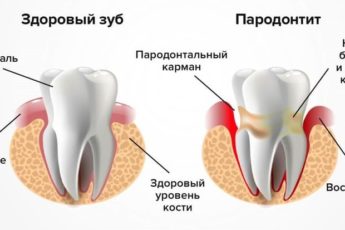 Простой способ сохранения здоровья зубов до старости