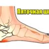 Пяточная шпора: 6 домашних средств для быстрого устранения боли