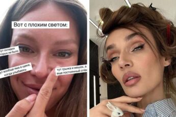 7 звёзд, пустившихся в новые переделки внешности: Неудачная пластика груди, зубы за 6 миллионов